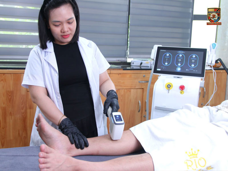 Chuyên viên sử dụng thiết bị laser để triệt lông chân cho khách hàng tại một địa chỉ triệt lông lưng và toàn thân uy tín.