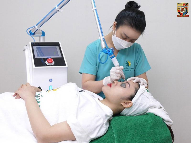 Chuyên viên thẩm mỹ dùng công nghệ laser hiện đại để xóa xăm chân mày cho khách hàng
