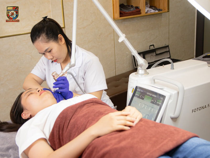 Best CO2 fractional laser training center in Hanoi practical session