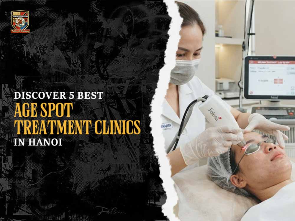 Discover five best age spot treatment clinics in Hanoi banner