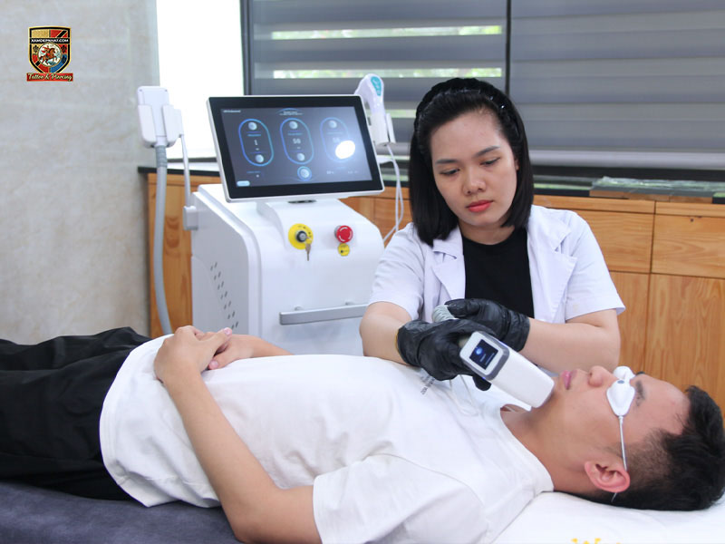 Trainee practicing laser treatment on a model at the best laser hair removal training center in Hanoi