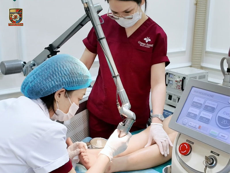 Bác sĩ Green Forest Clinic bắn laser trị liệu vùng chân cho khách hàng tại địa chỉ trị nám công nghệ cao
