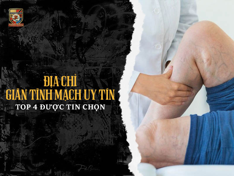 Địa chỉ giãn tĩnh mạch uy tín top 4 được nhiều người tin chọn