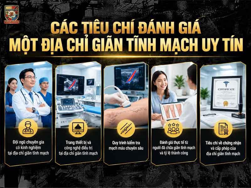 Các tiêu chí lựa chọn địa chỉ giãn tĩnh mạch uy tín và an toàn