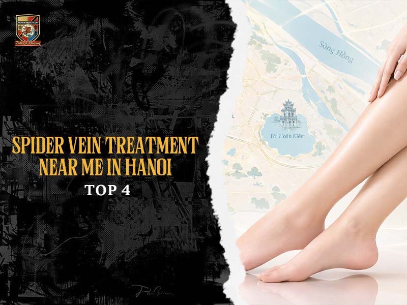 Banner showing smooth legs and map for top 4 spider vein treatment near me in Hanoi.