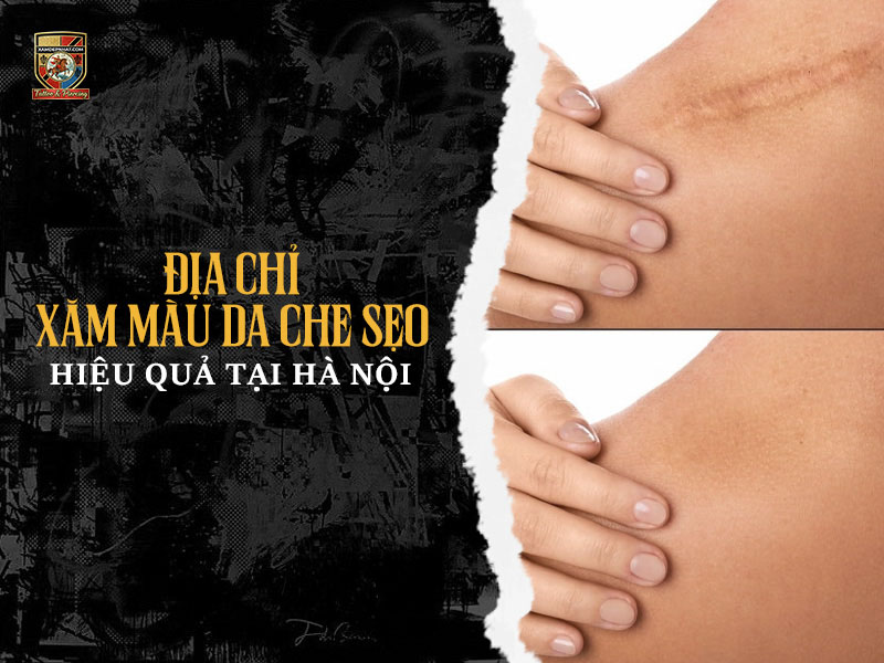 Trước và sau khi tìm đúng địa chỉ xăm màu da che sẹo tại Hà Nội làm mờ vết sẹo phẫu thuật ở vai